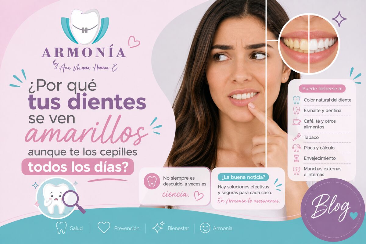 ¿Por qué tus dientes se ven amarillos aunque te los cepilles todos los días? — Armonía