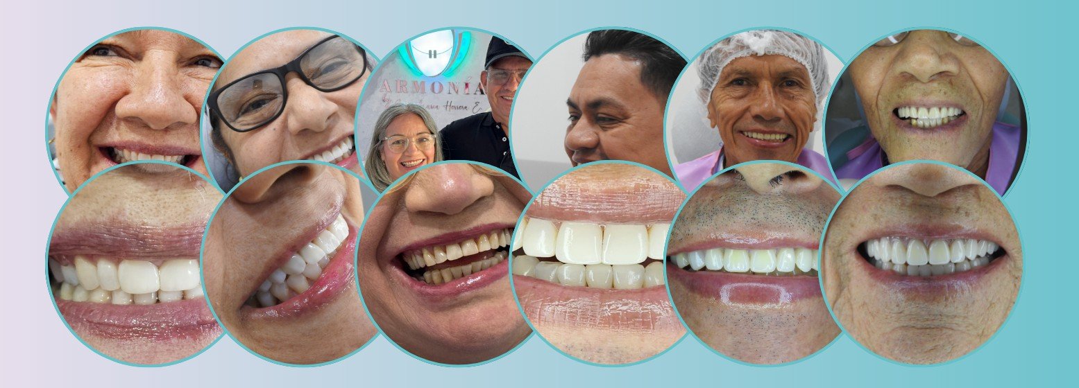 Pacientes reales de Armonía mostrando el resultado de sus tratamientos, con consentimiento de imagen